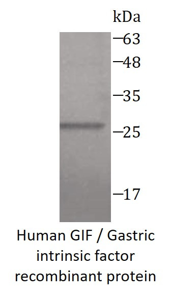 Human GIF / Gastric intrinsic factor recombinant protein (His-tagged)