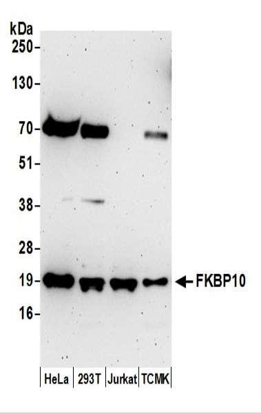 Anti-FKBP10