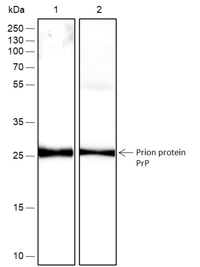 Anti-Recombinant Prion protein PrP, clone A418