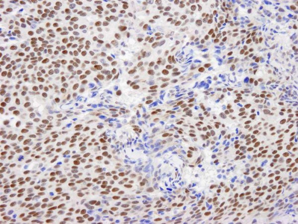 Anti-GTF2I/TFII-I (IHC)