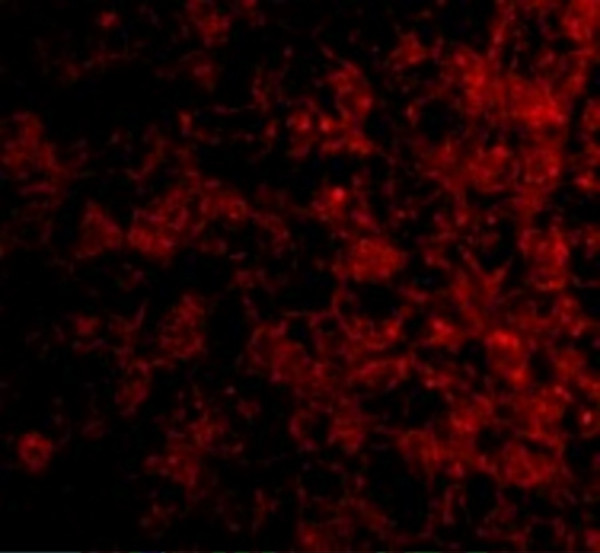Anti-CRLF2