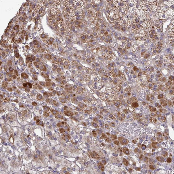 Anti-B4GALT6