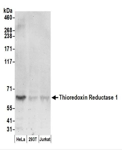 Anti-Thioredoxin Reductase 1/TXNRD1/TRXR1