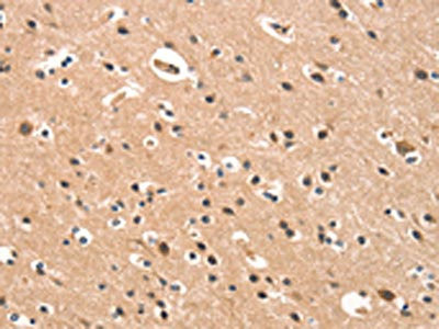 Anti-CYP46A1