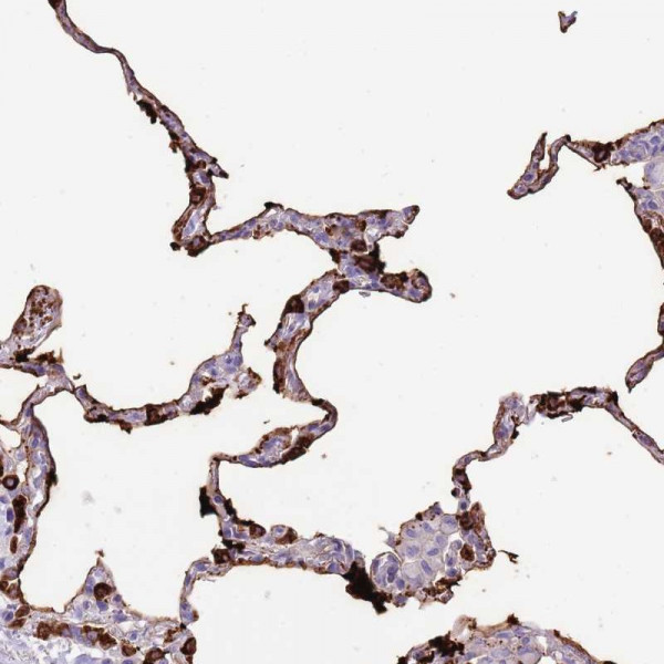 Anti-SFTPA1