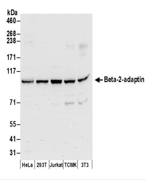 Anti-Beta-2-adaptin