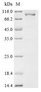 Putative exonuclease GOR (REXO1L1P), recombinant human
