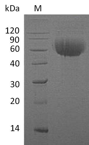 Interleukin-13 receptor subunit alpha-1 (IL13RA1), partial (Active), human, recombinant