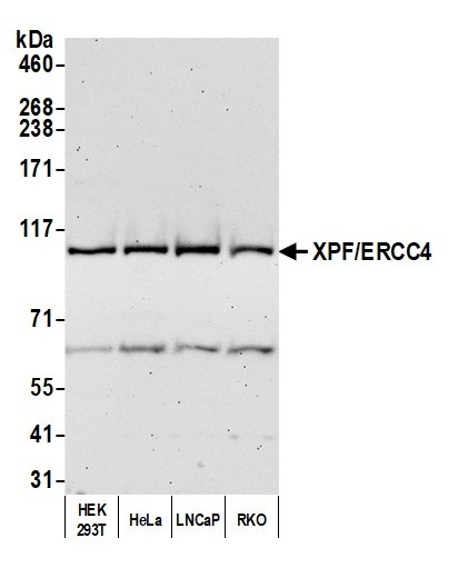 Anti-XPF/ERCC4