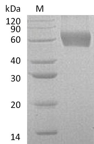 Granulocyte-macrophage colony-stimulating factor receptor subunit alpha (CSF2RA), partial (Active),