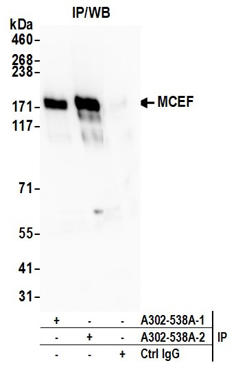 Anti-MCEF