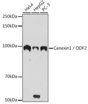 Anti-Cenexin1 / ODF2