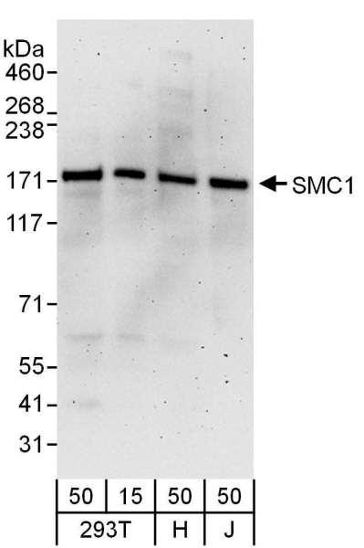 Anti-SMC1