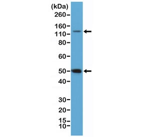 Anti-NFKB1 (recombinant antibody), clone RM299