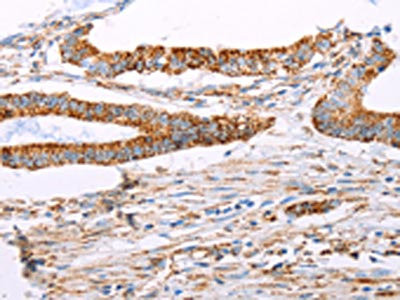 Anti-ATP5J