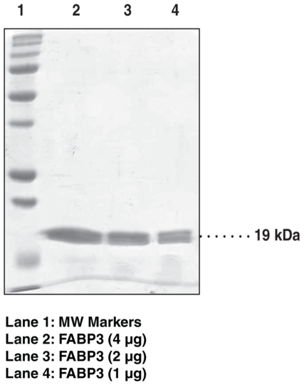 FABP3 (human, recombinant)