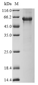 G/T mismatch-specific thymine DNA glycosylase (TDG), human, recombinant
