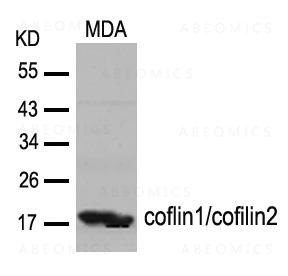 Anti-coflin1/cofilin2 (Ab-88)