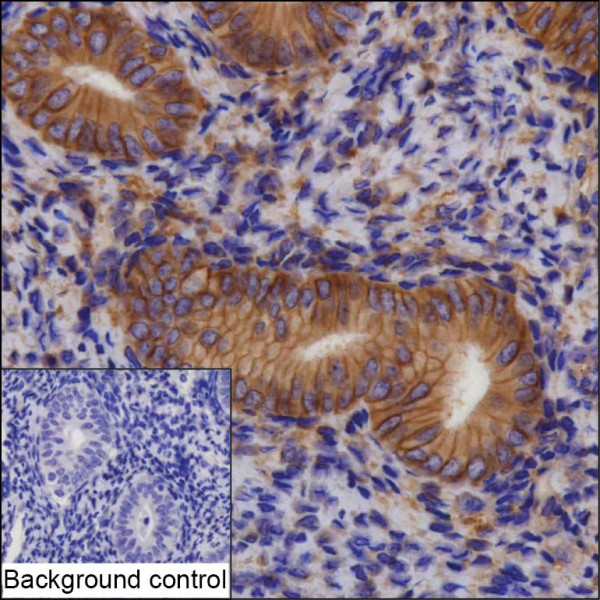 Anti-ATP2B4