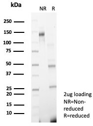 Anti-GCLM / Glutamate-Cysteine Ligase Regulatory Subunit, clone GCLM/4068
