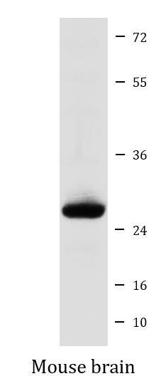 Anti-MOG / Myelin oligodendrocyte glycoprotein