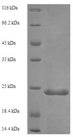 Complement C5 (C5), partial, human, recombinant