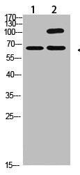 Anti-COL13A1