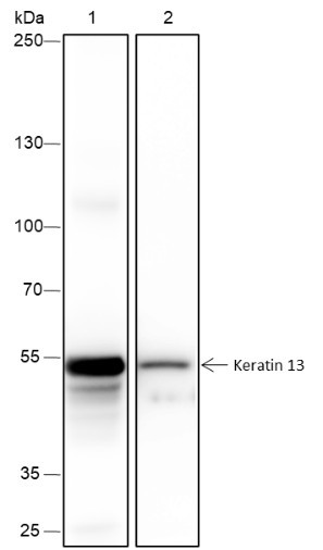Anti-Recombinant Keratin 13, clone A402