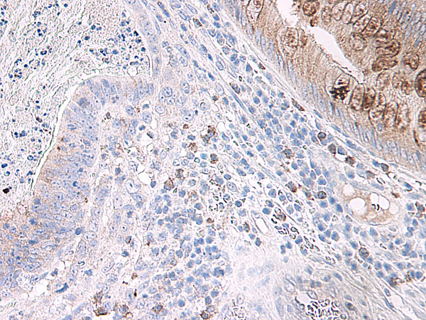 Anti-CL15
