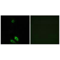 Anti-AKR1CL1