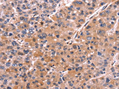 Anti-COL20A1