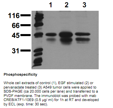 Anti-phospho-CREB (Ser133) / phospho-ATF1 (Ser63), clone 10E1