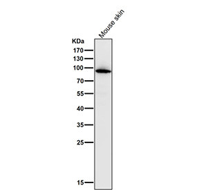 Anti-MPO / Myeloperoxidase, clone 32M13