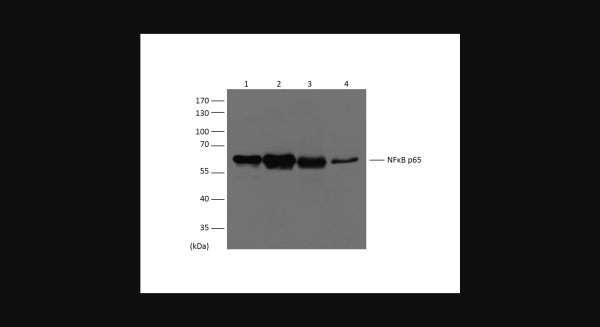 Anti-NFkB p65, monoclonal