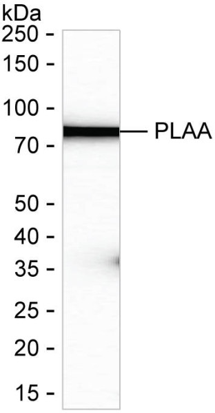 Anti-Phospholipase A2 Activator Protein
