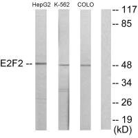 Anti-E2F2