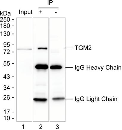 Anti-TGM2
