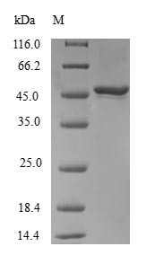 Ras-related protein Rab-31 (RAB31), human, recombinant