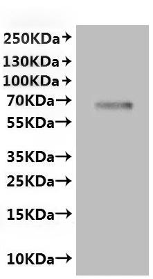 Transient receptor potential cation channel subfamily V member 6 (Trpv6)-VLPs, recombinant rat