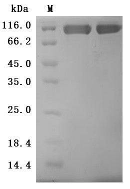 CUB domain-containing protein 1 (CDCP1), partial (Active), human, recombinant