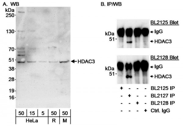 Anti-HDAC3