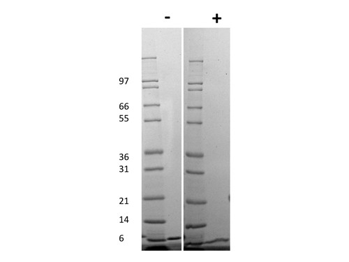 Gro-alpha /KC (CXCL1)