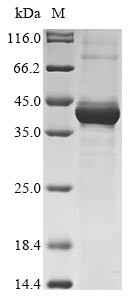 Maternal embryonic leucine zipper kinase (MELK), partial, human, recombinant