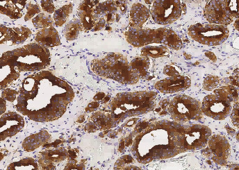 Anti-CD164 Monoclonal Antibody
