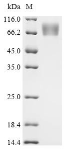 Protein UL16 (UL16), partial, recombinant human cytomegalovirus