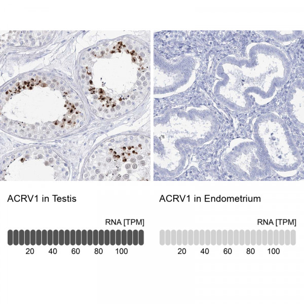 Anti-ACRV1