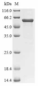 LPS-assembly protein lptD (lptD), partial, Francisella tularensis subsp. tularensis, recombinant
