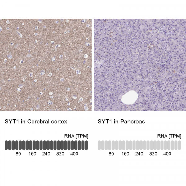 Anti-SYT1