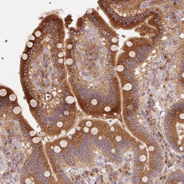 Anti-RAB1A