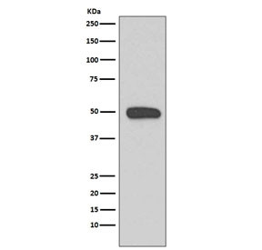 Anti-Cytokeratin 13 / KRT13, clone GAC-11